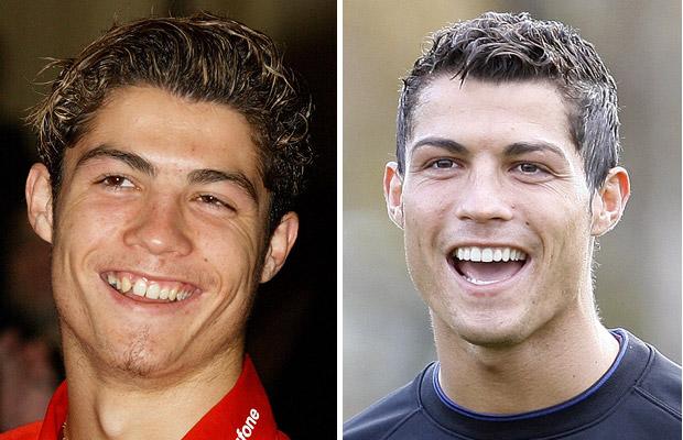Ronaldo-teeth 1421749i