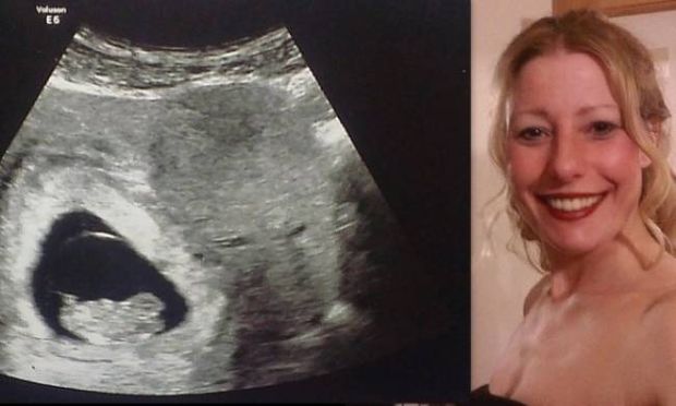 Έγκυος υποστηρίζει πως στο υπερηχογράφημα είδε δίπλα στο παιδί της...