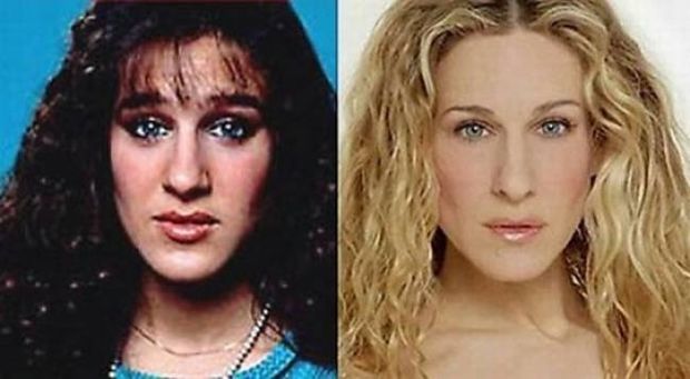 Απίστευτες μεταμορφώσεις: 11 διάσημοι πριν και μετά την πλαστική