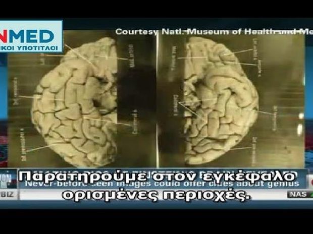 CNN: Εικόνες από τον εγκέφαλο του Αϊνστάιν (βίντεο)