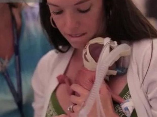 Το συγκλονιστικό video για την ανάπτυξη ενός πρόωρου μωρού