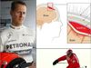 Michael Schumacher: Όλες οι λεπτομέρειες για το ατύχημα και το υποσκληρίδιο αιμάτωμα 