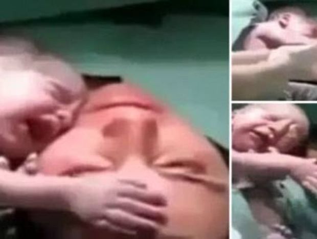 Μοναδικό βίντεο: Νεογέννητο μωρό δεν θέλει να αποχωριστεί τη μαμά του