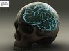 Όγκος στο κεφάλι: Δείτε ποια είναι τα ένοχα συμπτώματα