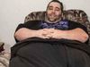 Είχε όγκο 46 κιλών στο όσχεό του και οι γιατροί του έλεγαν να... 
