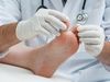 Μύκητες στα πόδια ή τα γεννητικά όργανα: Απαραίτητες συμβουλές πρόληψης & αντιμετώπισης 