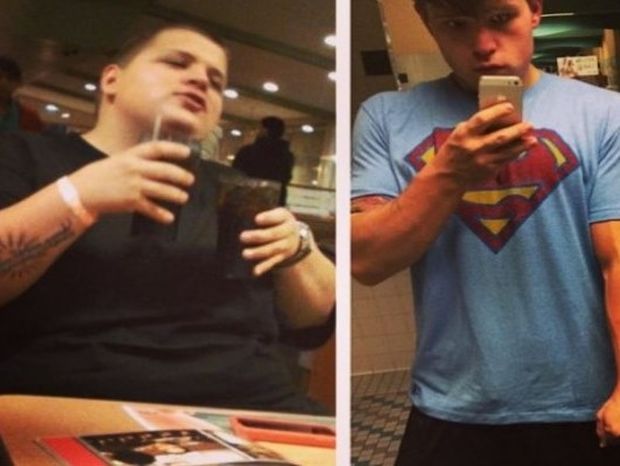 ΣΟΚ: Δείτε πώς έγινε το δέρμα ενός 21χρονου που έχασε 72 κιλά! (pics+video)