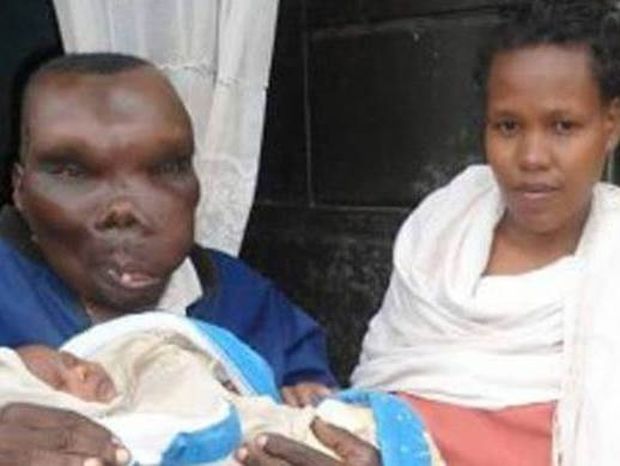 O πιο άσχημος άνδρας της Ουγκάντα έχει οκτώ παιδιά! (photos+videos) 