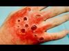 Δέκα ασθένειες που σκοτώνουν μέσα σε μία μέρα (βίντεο)