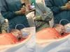 Αυτό το μικρό αγόρι γεννιέται μόνο του χωρίς τη βοήθεια των γιατρών - ΠΡΟΣΟΧΗ σκληρό βίντεο