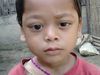 Ινδία: Το αγόρι με τα μάτια που αιμορραγούν – Σκληρές εικόνες