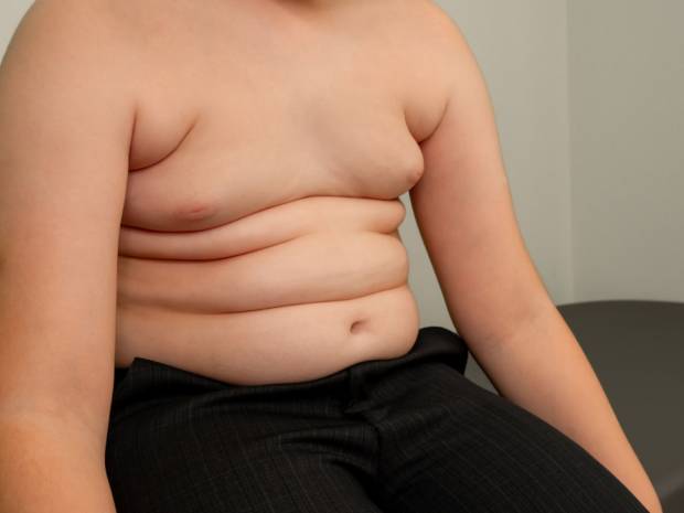 Μπορεί ένα παιδί να υποβληθεί σε επέμβαση απώλειας βάρους;